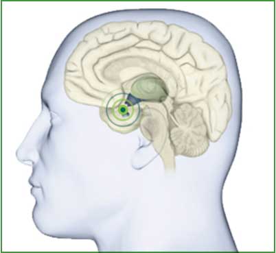 understanding-acromegaly.jpg