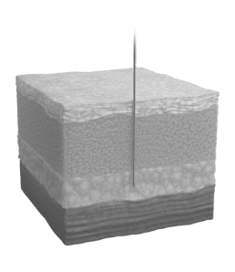 An illustration showing a needle going through layers of the skin to the deep subcutaneous tissue